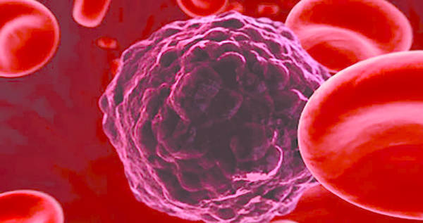 biopsia-liquida-prelievo-del-dna-diagnostica-tumori