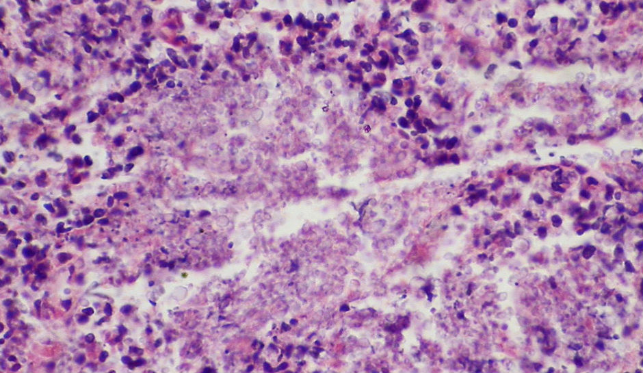 killer-fungus-fungo-candida-auris